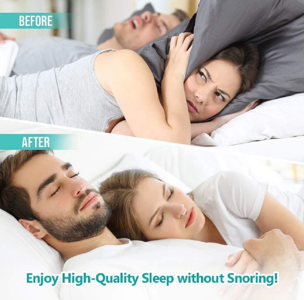 4-Pack Magnetic Anti-Snore Nose Clips – Silicone Snoring Aid for Better Sleep